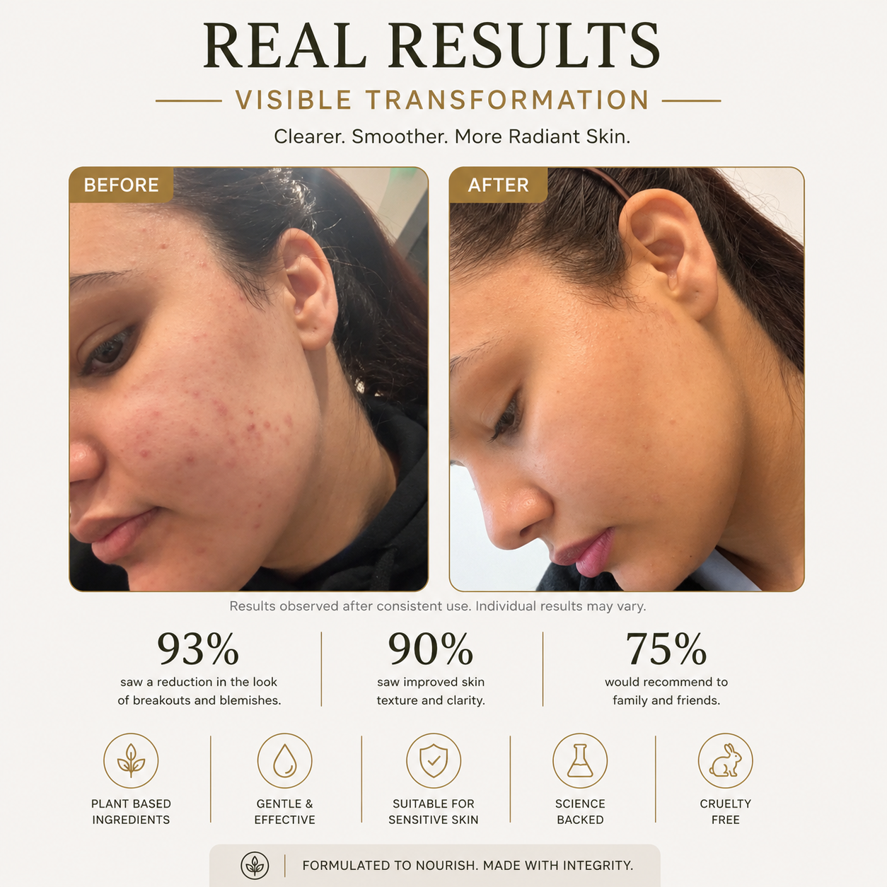 Dark Spot Correcting Serum Hyperpigmentation & Acne Mark Brightening Treatment with Vitamin C, Niacinamide & Tranexamic Acid