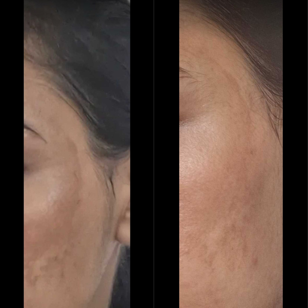 Nila Brightening Peel off Mask