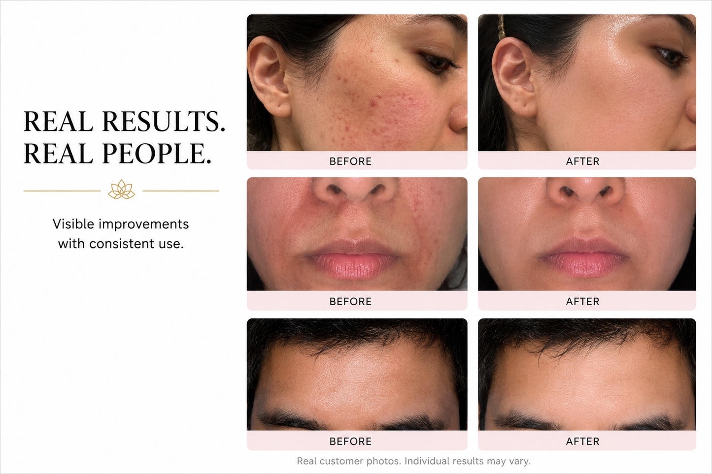 Fig Skin Barrier Repair Moisturiser