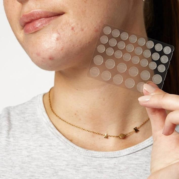 SHIFAH Acne Pimple Patches, 36 Patches