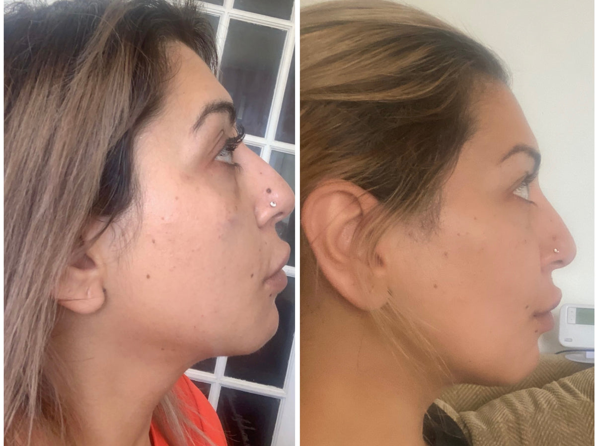 Skincare before and after: real SHIFAH customer profile showing clearer skin