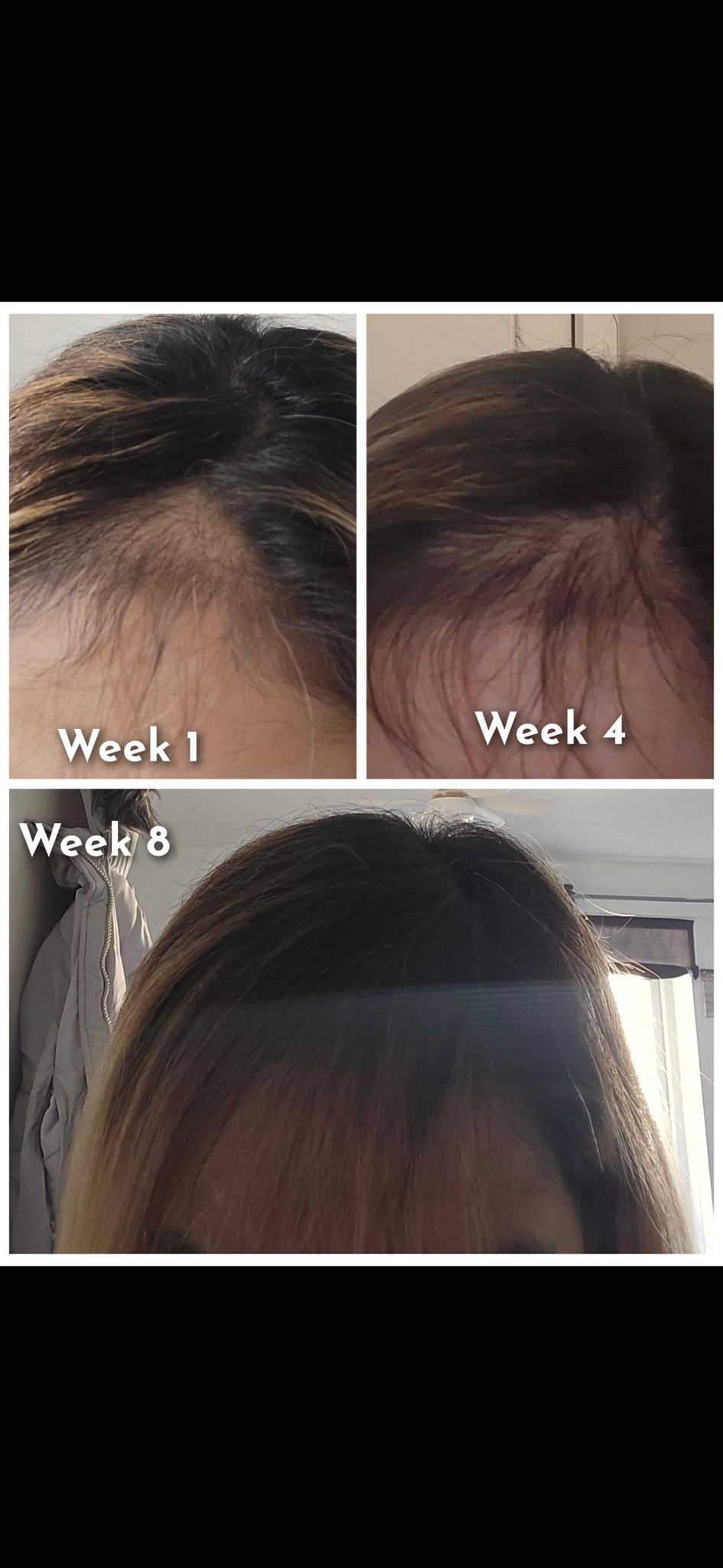 New! Sunnah Rice Water Hair Care Bundle