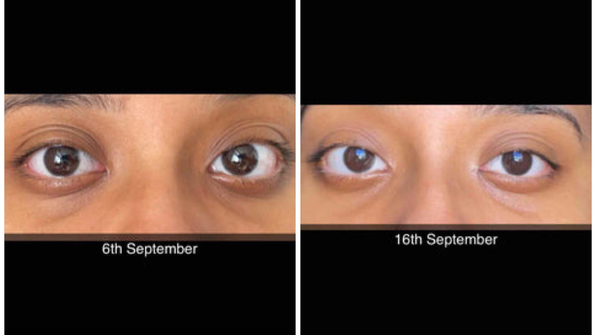 6th September