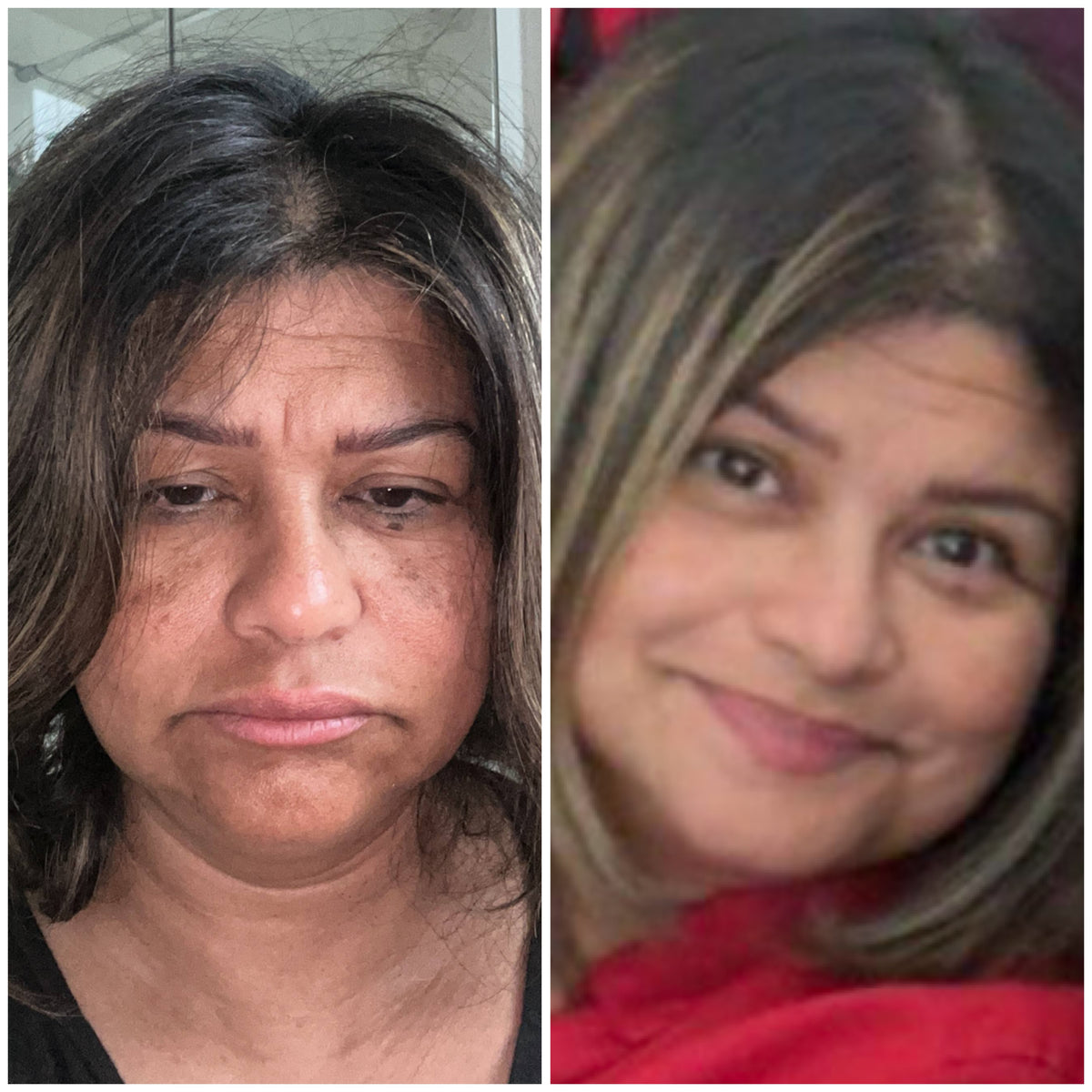 Facial skincare before and after: real SHIFAH customer result