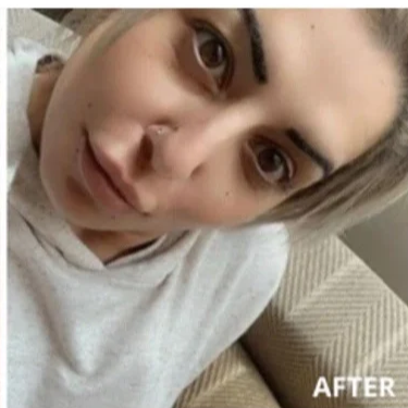 AFTER 4 WEEKS