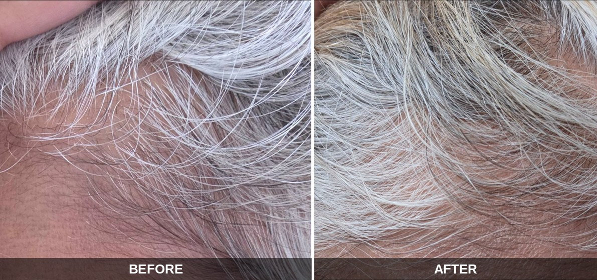 Haircare before and after: Jaz's hair and scalp result with SHIFAH haircare